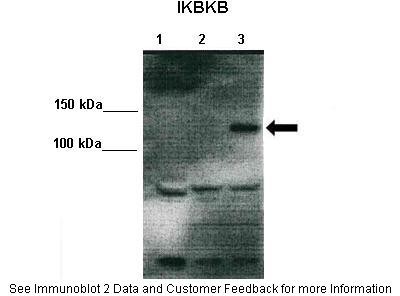 IKBKB antibody - middle region