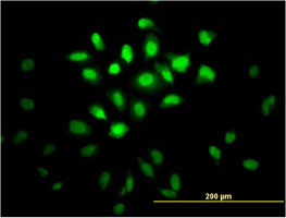 MSI1 Antibody (monoclonal) (M04)