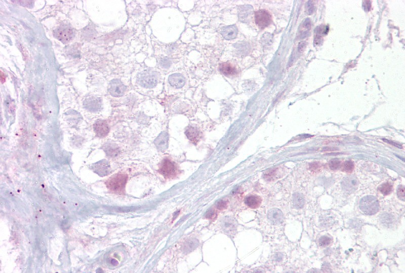 NR4A1 antibody - N-terminal region