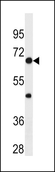 NFKBp65 Antibody