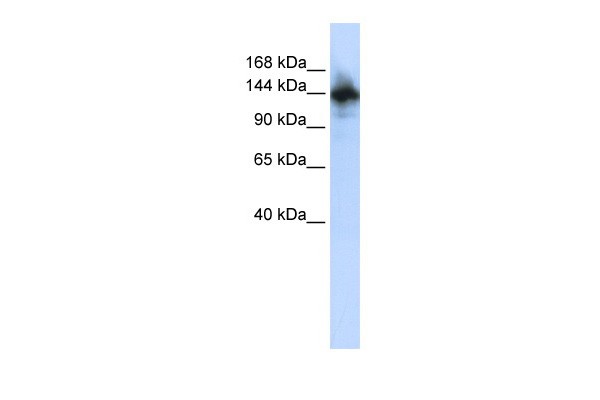 RBM6 antibody - N-terminal region