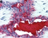 Mucin 1 Antibody, Monoclonal