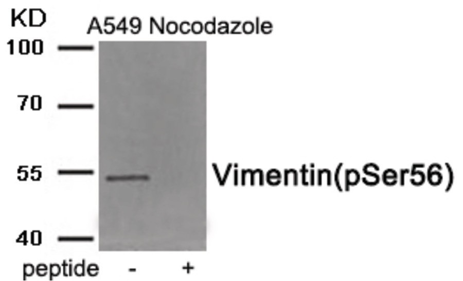 Vimentin (phospho Ser56) Antibody