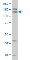 NRP1 Antibody (monoclonal) (M05)