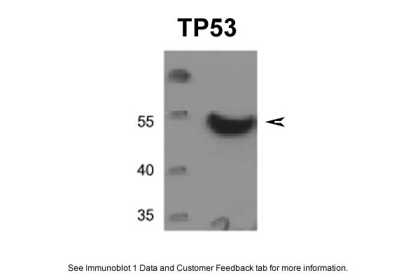 TP53 Antibody