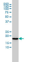 NAT5 Antibody (monoclonal) (M01)