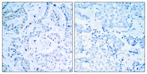 Estrogen Receptor-alpha antibody