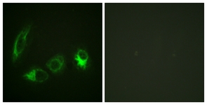 IRS-1 (Phospho-Ser323) antibody