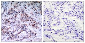 NF-kappaB p65 (Phospho-Thr435) antibody