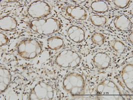 MTSS1 Antibody (monoclonal) (M01)