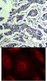 AKT1 / AKT2 / AKT3 (phospho Tyr315 / Tyr316 / Tyr312) Antibody