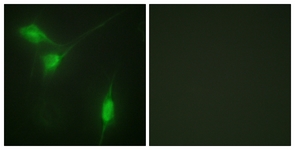 Akt (Phospho-Ser246) antibody
