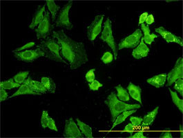 NODAL Antibody (monoclonal) (M03)