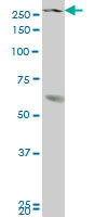 NSD1 Antibody (monoclonal) (M08)