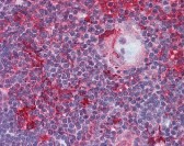 LCK Antibody