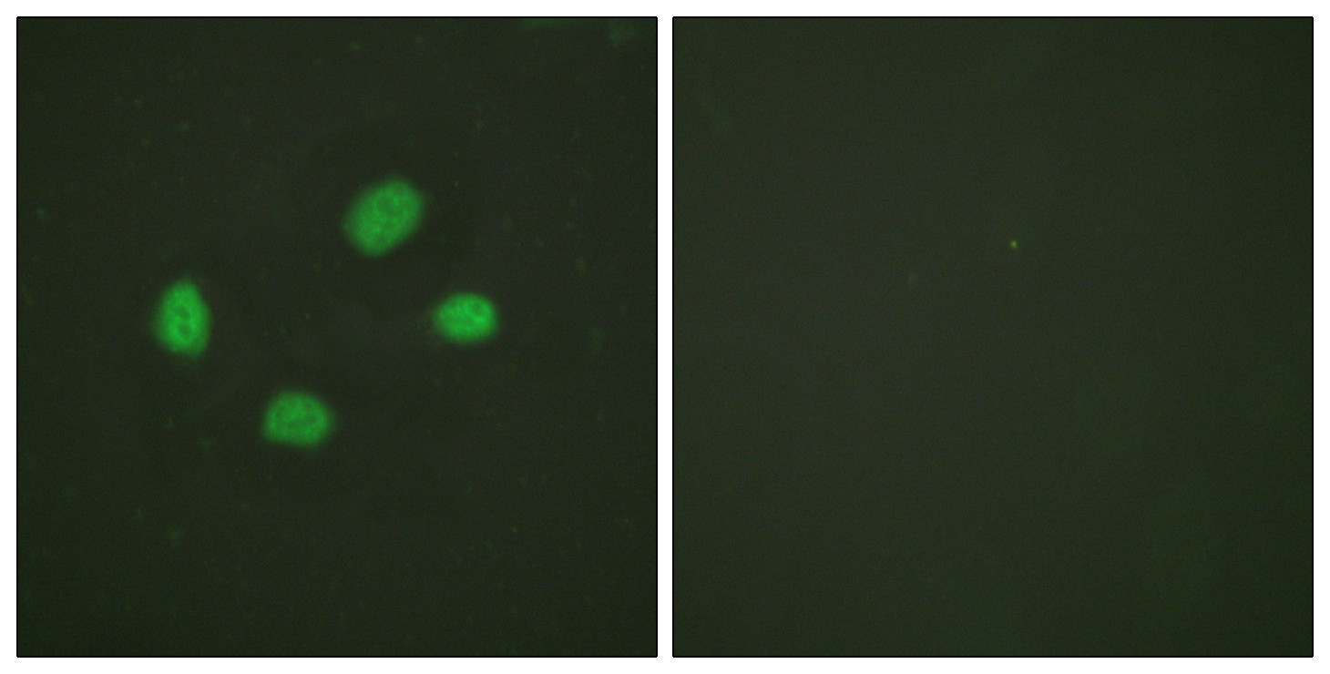Chk2 (phospho Thr383) Antibody