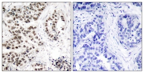 Chk2 (Phospho-Thr68) antibody