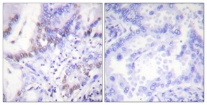 Abl (Phospho-Tyr412) antibody