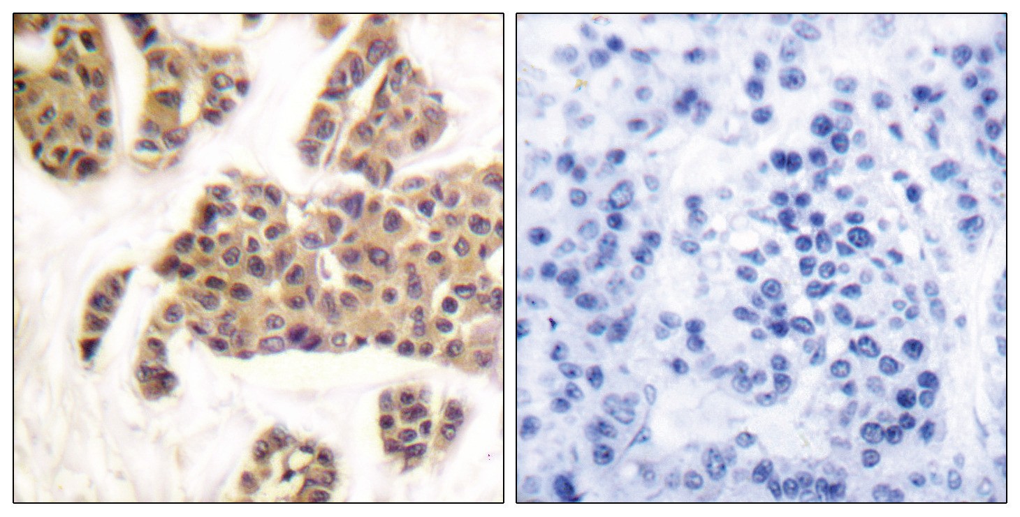 BAD (phospho Ser91/128) Antibody