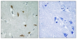 AKT1/3 (Phospho-Tyr437/434) antibody