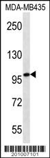 MYO1C Antibody (ascites)