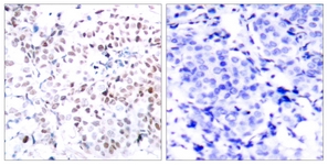 Myc (Phospho-Thr358) antibody