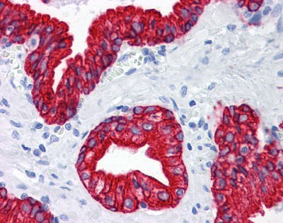 Keratin Antibody, Monoclonal