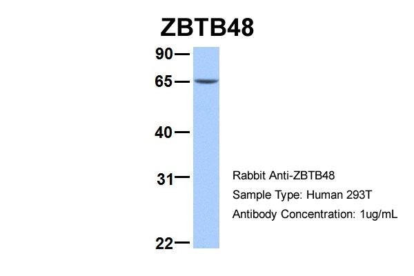 ZBTB48 antibody - N-terminal region