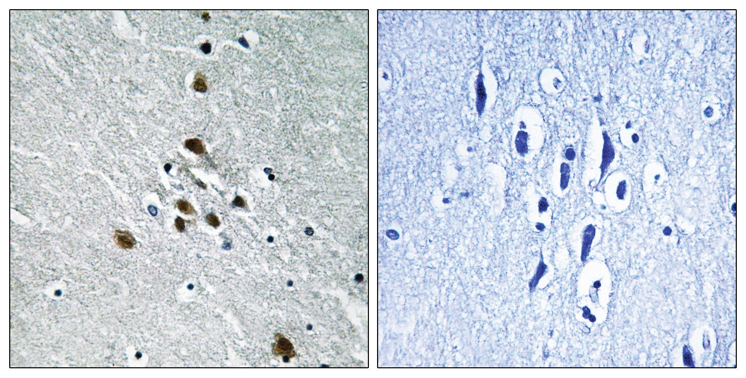 SF1 (phospho Ser82) Antibody