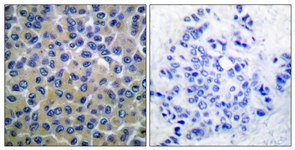 SYK (Phospho-Tyr348) antibody