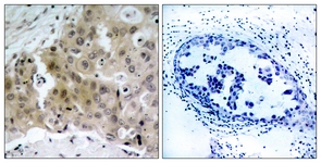 VEGFR2 (Phospho-Tyr1175) antibody