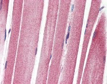 IGF1R Antibody