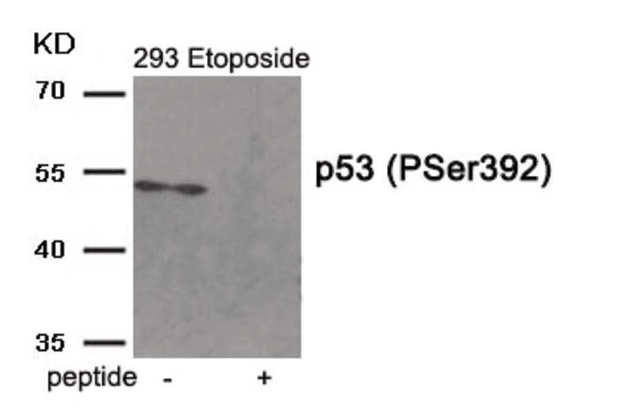p53 (phospho Ser392) Antibody