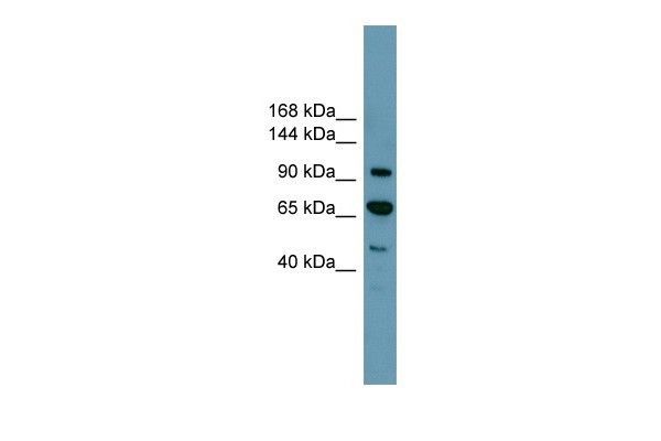 RB1 antibody - middle region