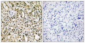 MYC antibody