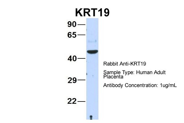 KRT19 antibody - N-terminal region