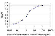 MAGI2 Antibody (monoclonal) (M01)