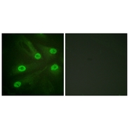 p53 (Acetyl-Lys386) antibody