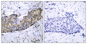 VEGFR2 antibody