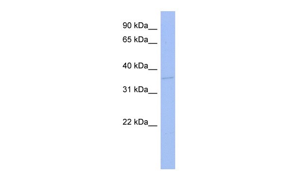 TLX3 antibody - N-terminal region