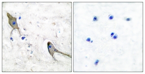 PYK2 antibody