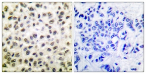 STAT5B antibody