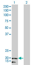 NDUFB5 Antibody (monoclonal) (M01)