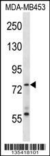 Mouse Syk Antibody