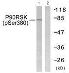 p90 RSK (Phospho-Ser380) antibody