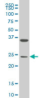 MESP1 Antibody (monoclonal) (M06)