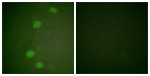 Retinoblastoma (Phospho-Ser249) antibody