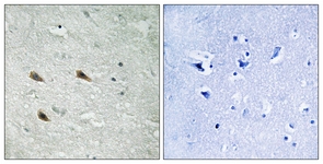 C-RAF (Phospho-Ser289) antibody