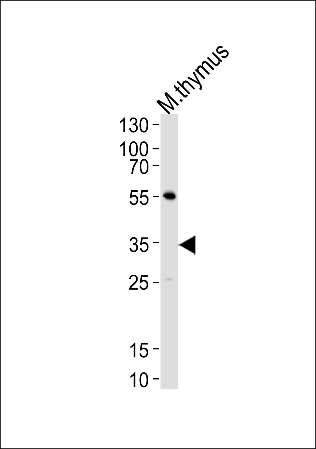 Mouse Lck Antibody