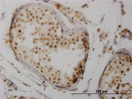 NFATC3 Antibody (monoclonal) (M02)